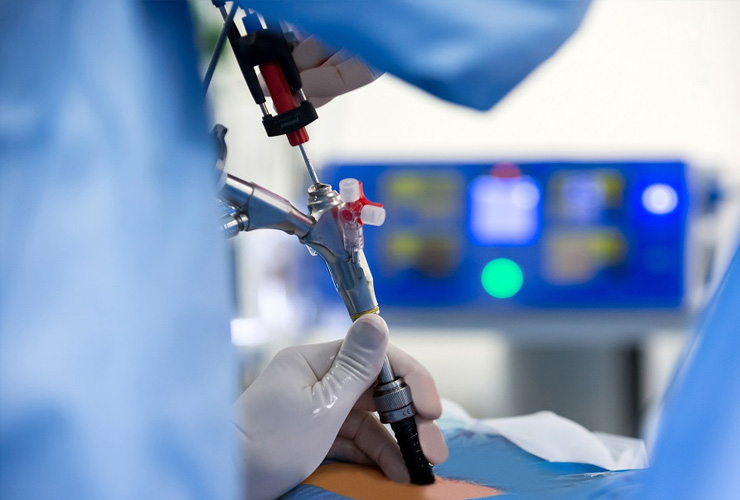Cirurgia Endoscópica da Coluna 