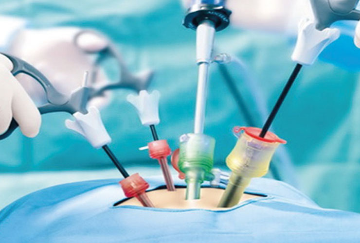 Disectomia Endoscópica Percutânea