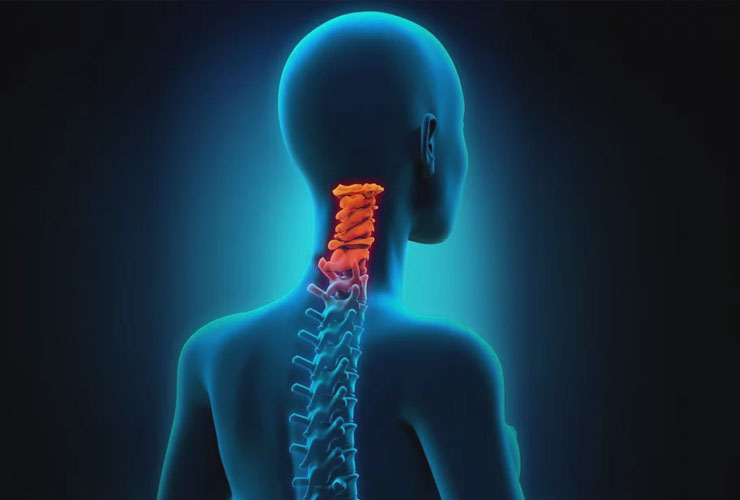 Dor Cervical